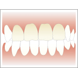 歯の色の確認