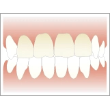 歯の色の確認のイメージ