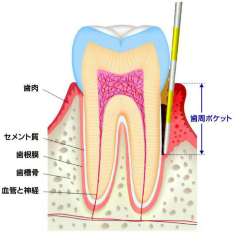 ブローピングのイメージ